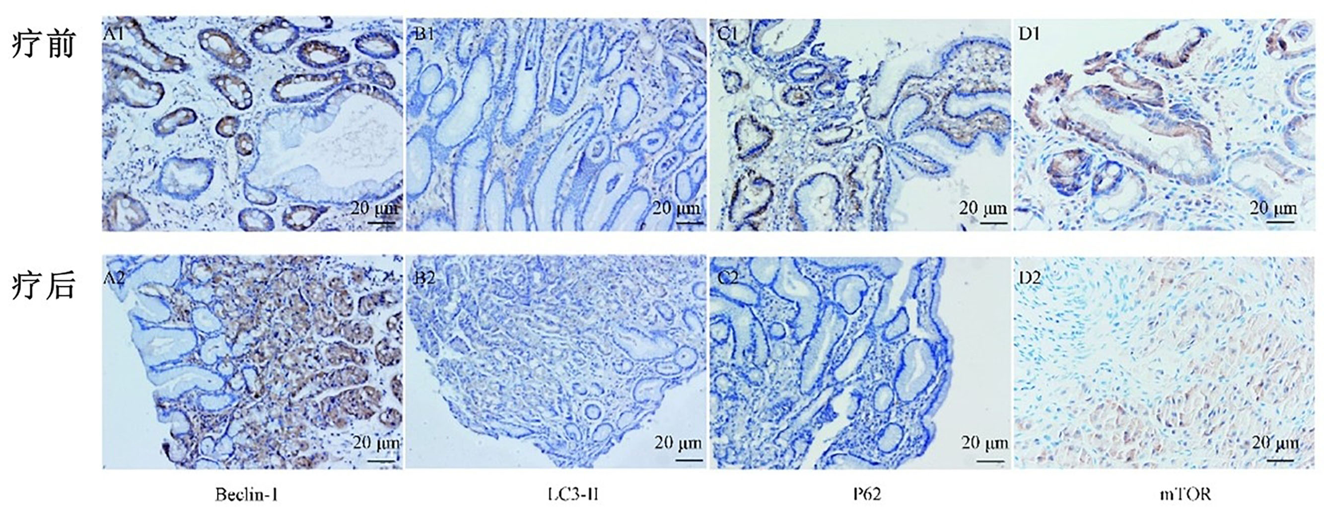 2026年国际足联世界杯