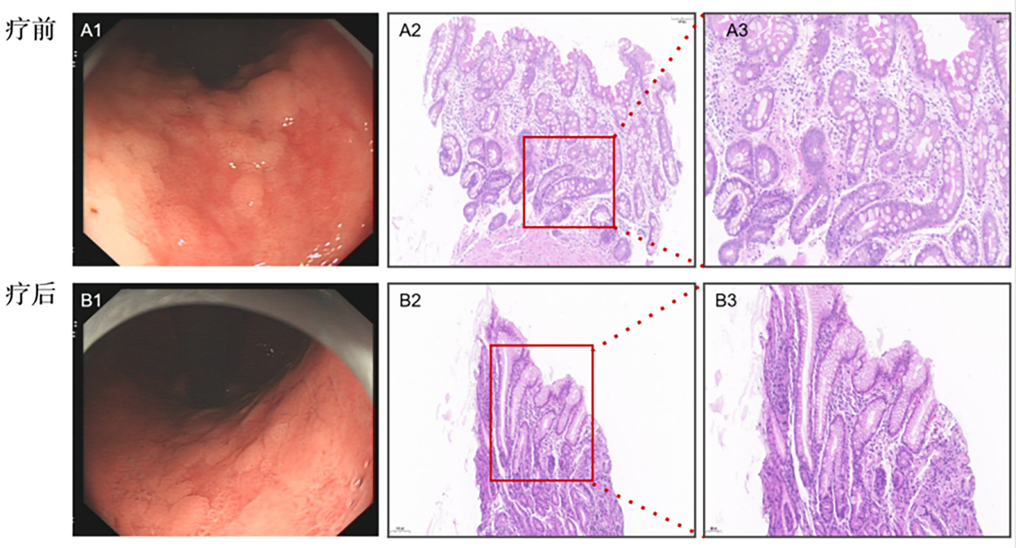 2026年国际足联世界杯