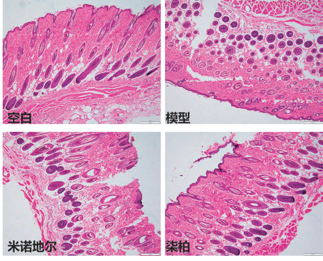 2026年国际足联世界杯