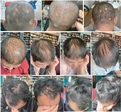 2026年国际足联世界杯