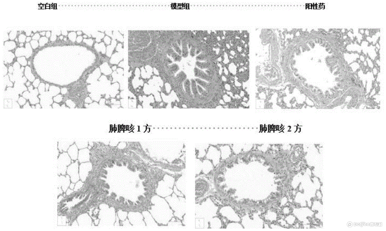 2026年国际足联世界杯